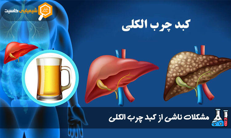 مشکلات ناشی از کبد چرب الکلی